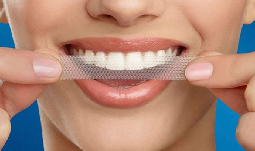 Tẩy trắng răng ngay tại nhà bằng miếng dán